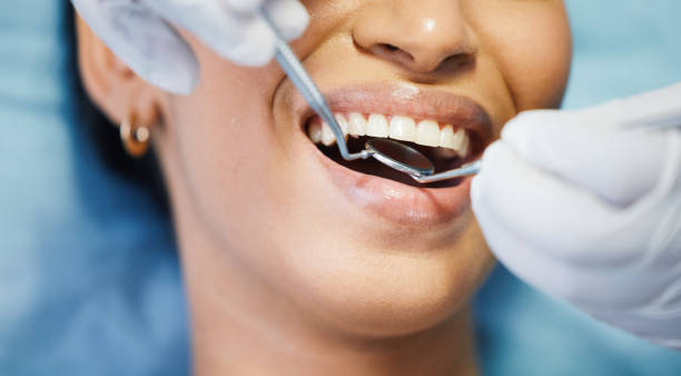 Best Emergency Root Canal Treatment in Orange, TX
